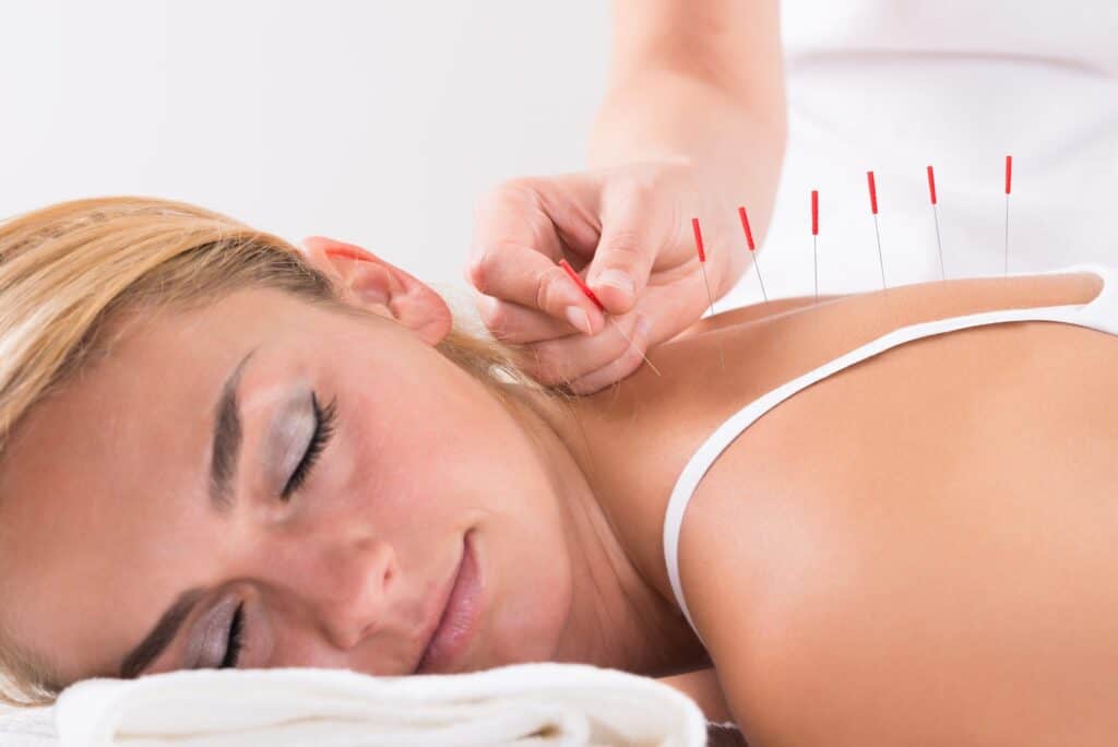 Medicare covers Acupuncture for chronic pain in lower back